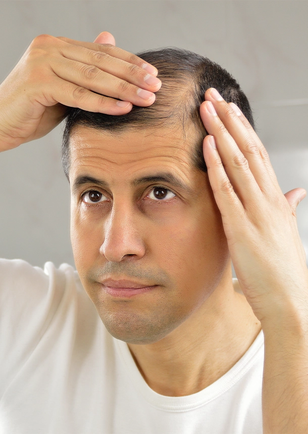 Alma TED Treatment for Hair Restoration