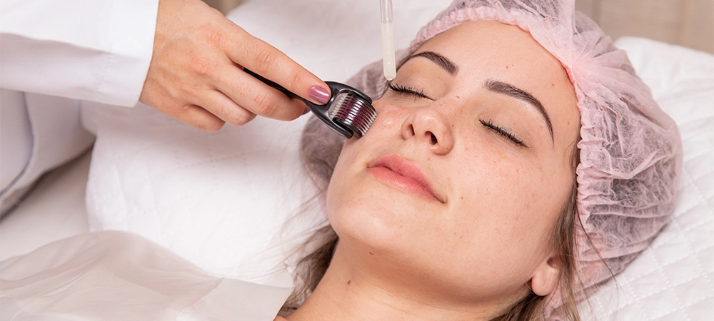 microneedling target various skin concerns